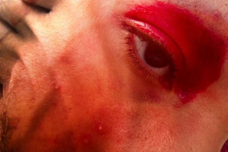 Eric-Bernardo-ENSAIO-5